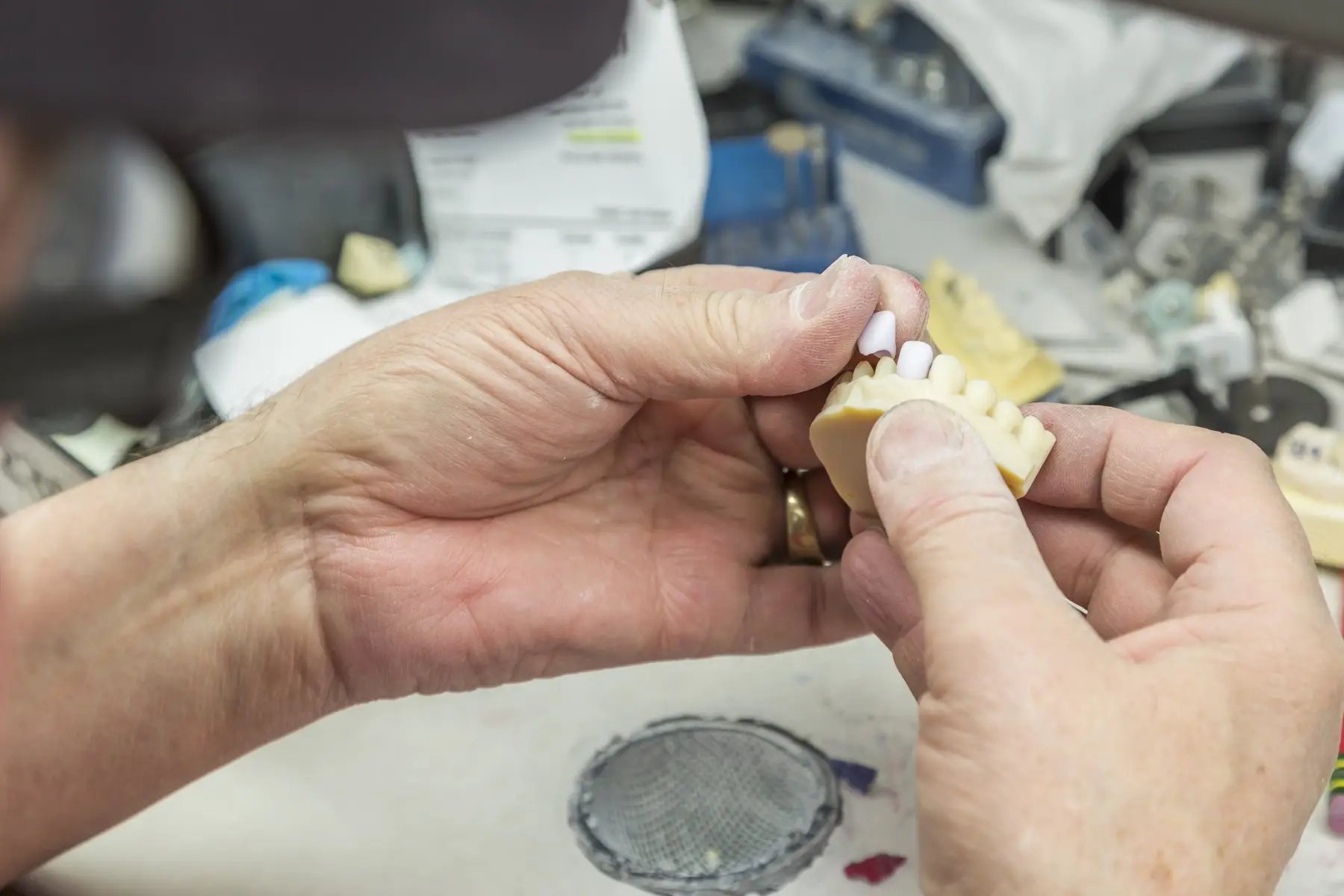 Zahntechnische Handarbeit bei der Anpassung einer prothetischen Versorgung